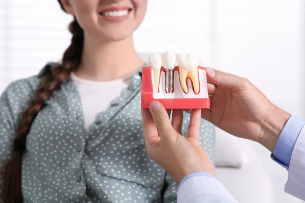 Reasons To Consider Getting Dental Implants From A Periodontist