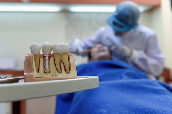 Dental Implant Recovery: What To Expect After The Procedure