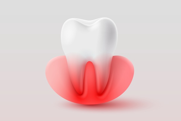 What To Know Before Starting Gum Disease Treatment