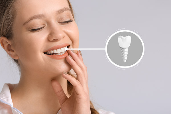 Gum Disease And Dental Implants