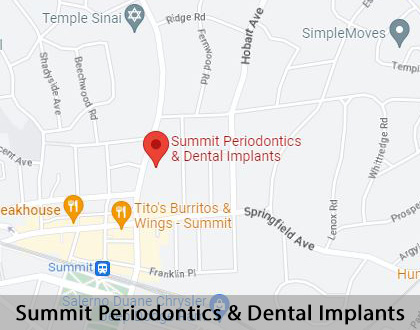 Map image for Crowns vs. Implants in Summit, NJ