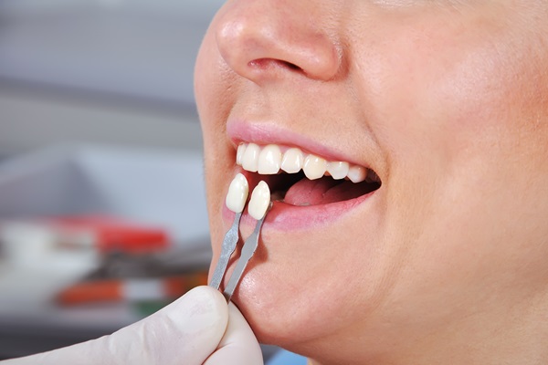 Tooth Replacement: Restore Your Smile With Confidence